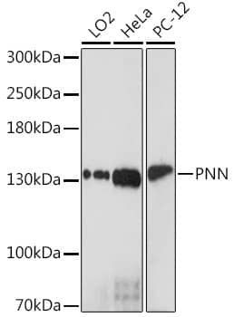 Western Blot: Pinin Antibody [NBP3-35709] - Western blot analysis of various lysates using Pinin Rabbit pAb at 1:1000 dilution.Secondary antibody: HRP-conjugated Goat anti-Rabbit IgG (H+L) at 1:10000 dilution.Lysates/proteins: 25ug per lane.Blocking buffer: 3% nonfat dry milk in TBST.Detection: ECL Enhanced Kit.Exposure time: 90s.