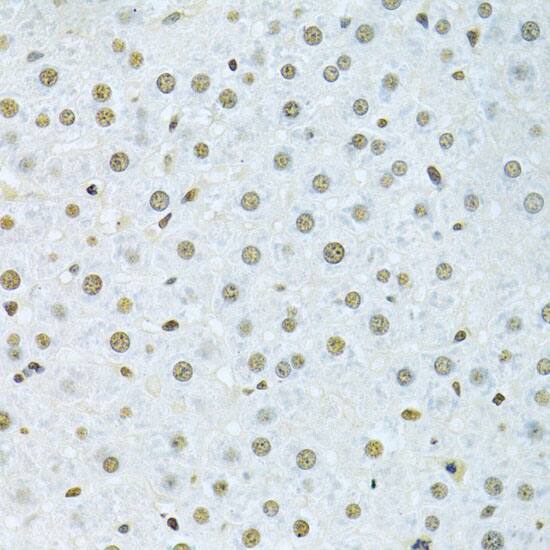 Immunohistochemistry: hnRNP K Antibody [NBP3-35712] - Immunohistochemistry analysis of paraffin-embedded Rat liver using hnRNP K Rabbit pAb at dilution of 1:200 (40x lens). Microwave antigen retrieval performed with 0.01M PBS Buffer (pH 7.2) prior to IHC staining.