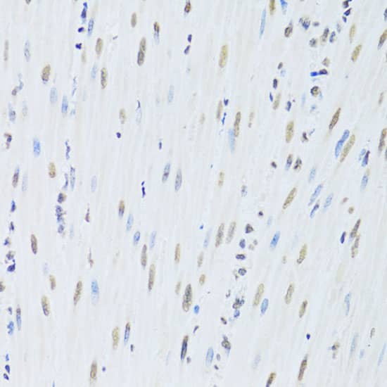 Immunohistochemistry: hnRNP K Antibody [NBP3-35712] - Immunohistochemistry analysis of paraffin-embedded Mouse esophagus using hnRNP K Rabbit pAb at dilution of 1:200 (40x lens). Microwave antigen retrieval performed with 0.01M PBS Buffer (pH 7.2) prior to IHC staining.