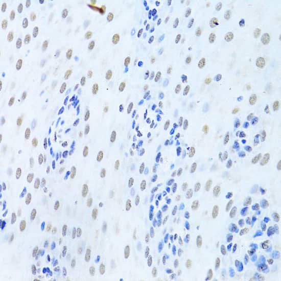 Immunohistochemistry: hnRNP K Antibody [NBP3-35712] - Immunohistochemistry analysis of paraffin-embedded Human esophagus using hnRNP K Rabbit pAb at dilution of 1:200 (40x lens). Microwave antigen retrieval performed with 0.01M PBS Buffer (pH 7.2) prior to IHC staining.