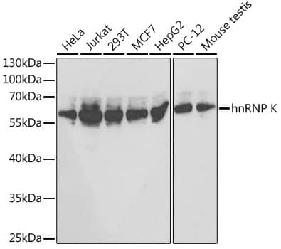 Western Blot: hnRNP K Antibody [NBP3-35712] - Western blot analysis of various lysates using hnRNP K Rabbit pAb at 1:1000 dilution.Secondary antibody: HRP-conjugated Goat anti-Rabbit IgG (H+L) at 1:10000 dilution.Lysates/proteins: 25ug per lane.Blocking buffer: 3% nonfat dry milk in TBST.