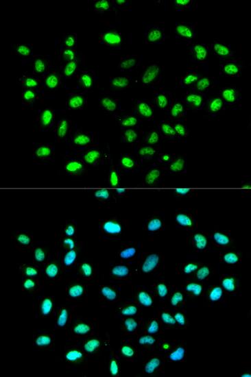 Immunocytochemistry/ Immunofluorescence: hnRNP K Antibody [NBP3-35712] - Immunofluorescence analysis of MCF-7 cells using hnRNP K Rabbit pAb. Secondary antibody: Cy3-conjugated Goat anti-Rabbit IgG (H+L) at 1:500 dilution. Blue: DAPI for nuclear staining.