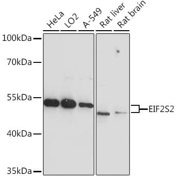 Western Blot: EIF2 beta Antibody [NBP3-35714] - Western blot analysis of various lysates using EIF2 beta Rabbit pAb at 1:3000 dilution.Secondary antibody: HRP-conjugated Goat anti-Rabbit IgG (H+L) at 1:10000 dilution.Lysates/proteins: 25ug per lane.Blocking buffer: 3% nonfat dry milk in TBST.Detection: ECL Basic Kit.Exposure time: 60s.