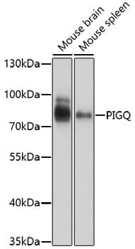 Western Blot: PIGQ Antibody [NBP3-35715] - Western blot analysis of various lysates using PIGQ Rabbit pAb at 1:1000 dilution.Secondary antibody: HRP-conjugated Goat anti-Rabbit IgG (H+L) at 1:10000 dilution.Lysates/proteins: 25ug per lane.Blocking buffer: 3% nonfat dry milk in TBST.Detection: ECL Basic Kit.Exposure time: 1s.