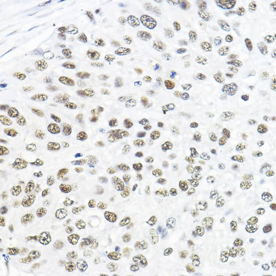 Immunohistochemistry TFIIB Antibody