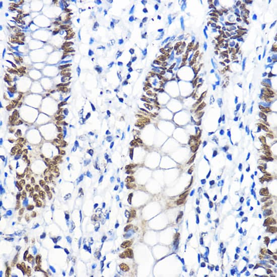 Immunohistochemistry TFIIB Antibody