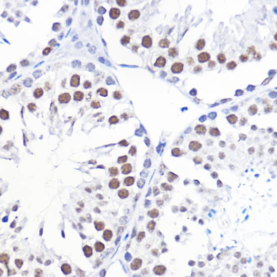 Immunohistochemistry TFIIB Antibody