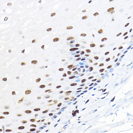 Immunohistochemistry: TFIIB Antibody [NBP3-35718] - Immunohistochemistry analysis of paraffin-embedded Human esophageal using TFIIB Rabbit pAb at dilution of 1:100 (40x lens). High pressure antigen retrieval performed with 0.01M Citrate Bufferr (pH 6.0) prior to IHC staining.