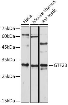 Western Blot: TFIIB Antibody [NBP3-35718] - Western blot analysis of various lysates using TFIIB Rabbit pAb at 1:1000 dilution.Secondary antibody: HRP-conjugated Goat anti-Rabbit IgG (H+L) at 1:10000 dilution.Lysates/proteins: 25ug per lane.Blocking buffer: 3% nonfat dry milk in TBST.Detection: ECL Enhanced Kit.Exposure time: 180s.