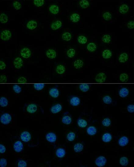 Immunocytochemistry/ Immunofluorescence: TFIIB Antibody [NBP3-35718] - Immunofluorescence analysis of L929 cells using TFIIB Rabbit pAb at dilution of 1:100 (40x lens). Secondary antibody: Cy3-conjugated Goat anti-Rabbit IgG (H+L) at 1:500 dilution. Blue: DAPI for nuclear staining.