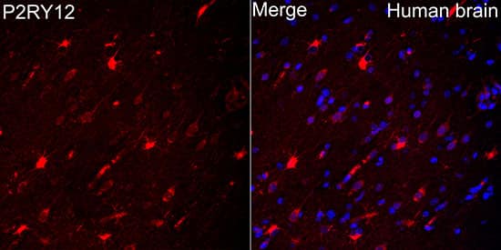 Western Blot: P2Y12/P2RY12 Antibody [NBP3-35719] - Western blot analysis of lysates from Mouse brain using P2Y12/P2RY12 Rabbit pAb at 1:2000 dilution.Secondary antibody: HRP-conjugated Goat anti-Rabbit IgG (H+L) at 1:10000 dilution.Lysates/proteins: 25 ug per lane.Blocking buffer: 3% nonfat dry milk in TBST.Detection: ECL Basic Kit.Exposure time: 45s.