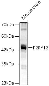 Western Blot: P2Y12/P2RY12 Antibody [NBP3-35719] - Western Blot analysis of lysates from Mouse brain using P2Y12/P2RY12 Rabbit pAb at 1:2000 dilution.Secondary antibody: HRP-conjugated Goat anti-Rabbit IgG (H+L) at 1:10000 dilution.Lysates/proteins: 25 ug per lane.Blocking buffer: 3% nonfat dry milk in TBST.Detection: ECL Basic Kit.Exposure time: 45s.