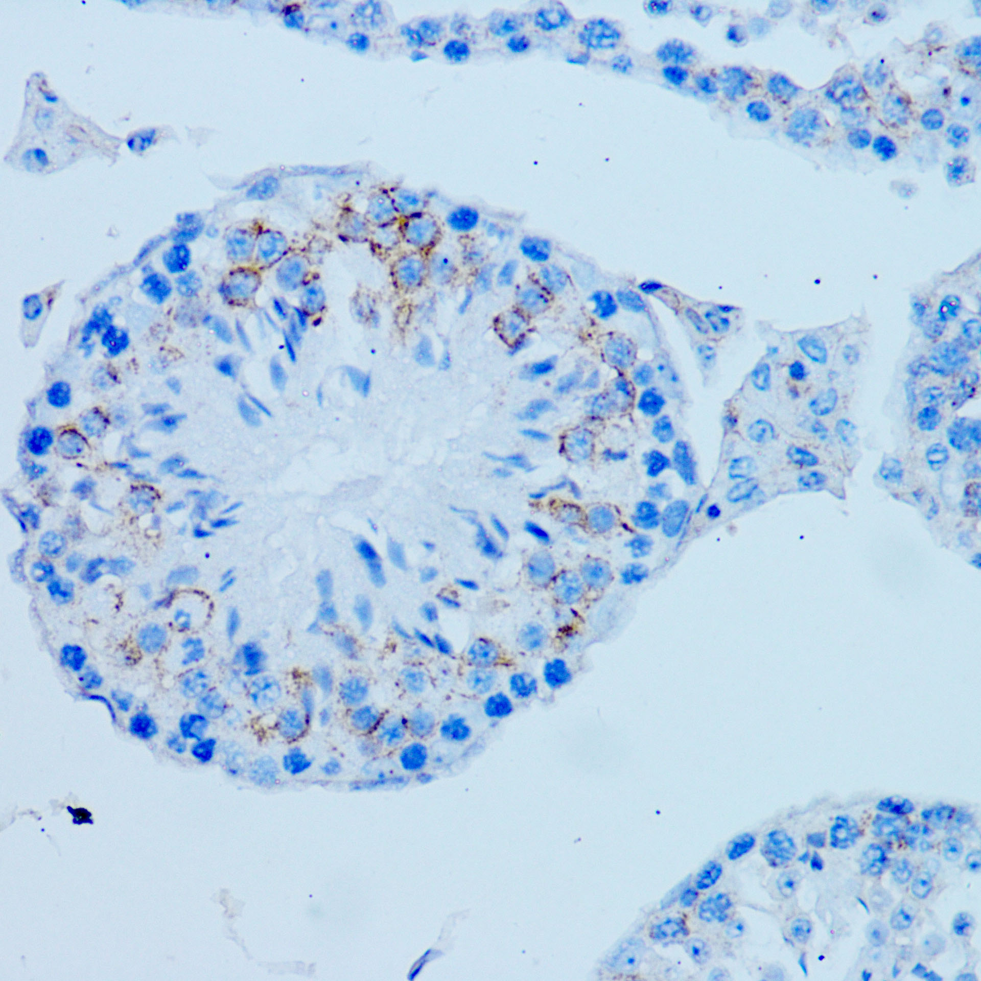 Immunohistochemistry: ARMER Antibody [NBP3-35720] - Immunohistochemistry analysis of ARMER in paraffin-embedded Mouse testis tissue using ARMER Rabbit pAb at a dilution of 1:100 (40x lens). Microwave antigen retrieval performed with 0.01M PBS Buffer(pH 7.2) prior to IHC staining.