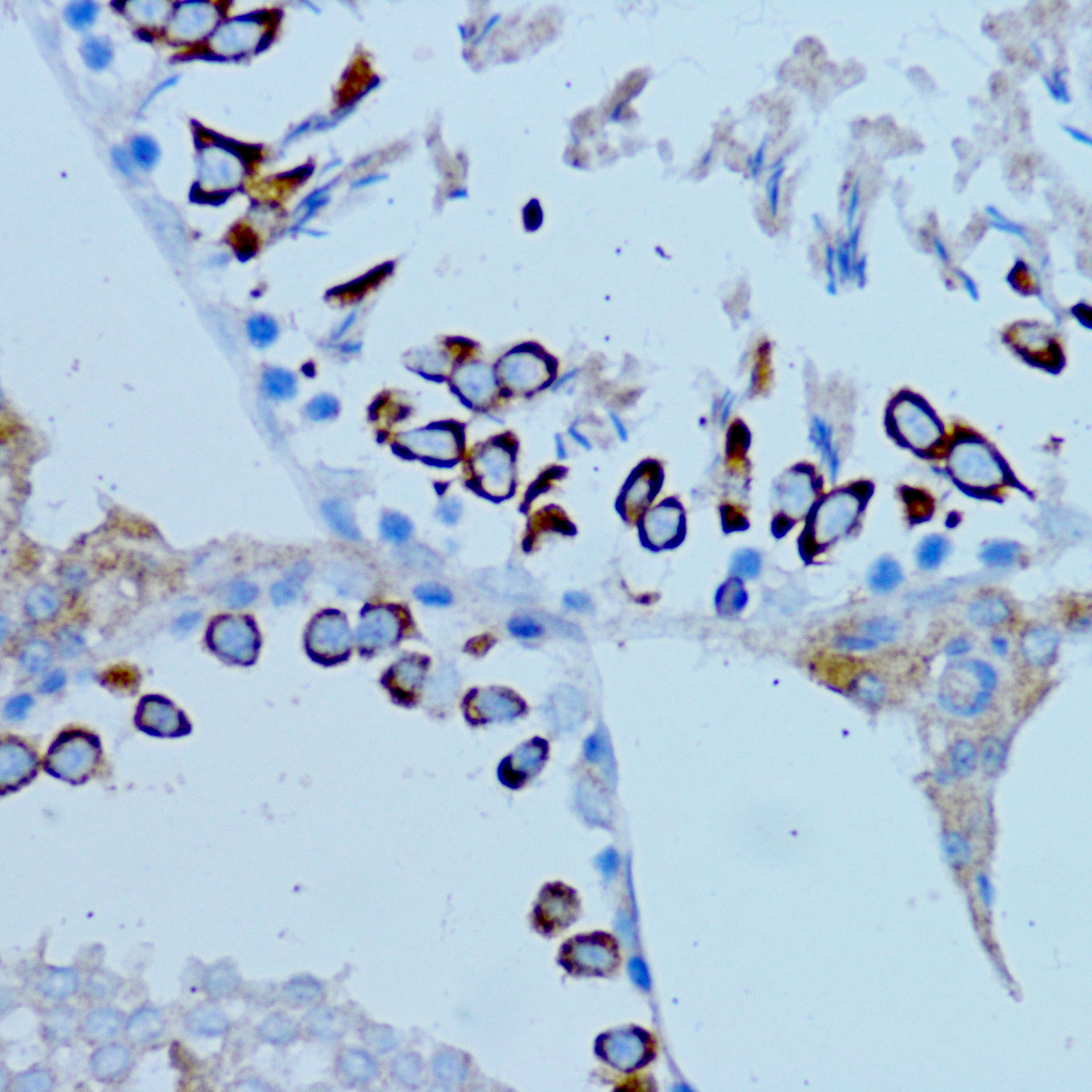 Immunohistochemistry: ARMER Antibody [NBP3-35720] - Immunohistochemistry analysis of ARMER in paraffin-embedded Rat testis tissue using ARMER Rabbit pAb at a dilution of 1:100 (40x lens). Microwave antigen retrieval performed with 0.01M PBS Buffer(pH 7.2) prior to IHC staining.