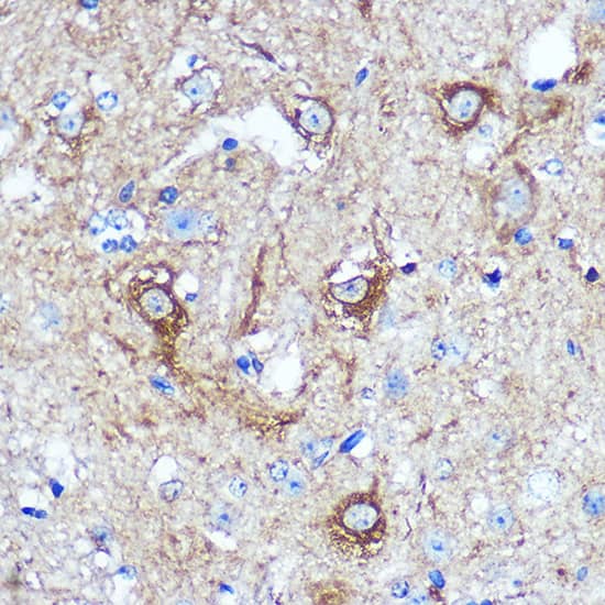 Immunohistochemistry KIBRA Antibody