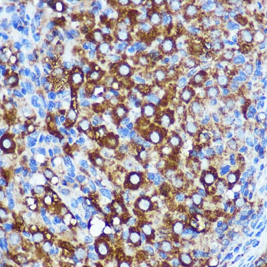 Immunohistochemistry KIBRA Antibody