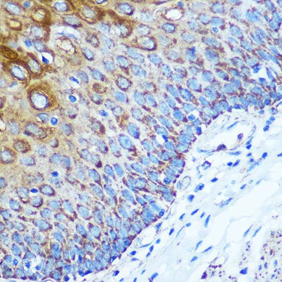 Immunohistochemistry KIBRA Antibody