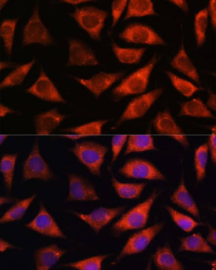 Immunocytochemistry/ Immunofluorescence: TMX2 Antibody [NBP3-35724] - Immunofluorescence analysis of L929 cells using TMX2 Rabbit pAb at dilution of 1:100. Secondary antibody: Cy3-conjugated Goat anti-Rabbit IgG (H+L) at 1:500 dilution. Blue: DAPI for nuclear staining.