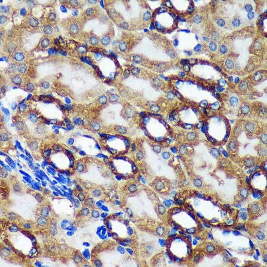 Immunohistochemistry: TMX2 Antibody [NBP3-35724] - Immunohistochemistry analysis of paraffin-embedded Mouse kidney using TMX2 Rabbit pAb at dilution of 1:100 (40x lens). Microwave antigen retrieval performed with 0.01M Tris/EDTA Buffer (pH 9.0) prior to IHC staining.