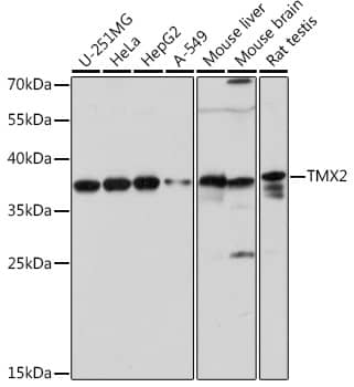 Western Blot: TMX2 Antibody [NBP3-35724] - Western blot analysis of various lysates using TMX2at 1:1000 dilution.Secondary antibody: HRP-conjugated Goat anti-Rabbit IgG (H+L) at 1:10000 dilution.Lysates/proteins: 25ug per lane.Blocking buffer: 3% nonfat dry milk in TBST.Detection: ECL Basic Kit.Exposure time: 30s.