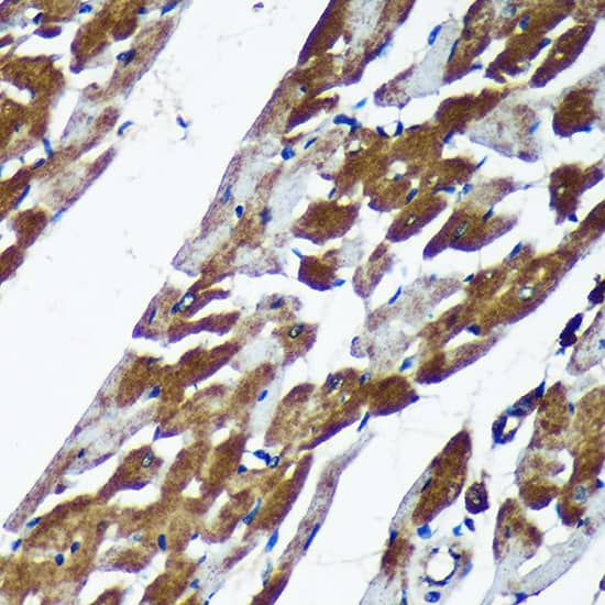 Immunohistochemistry: TMX2 Antibody [NBP3-35724] - Immunohistochemistry analysis of paraffin-embedded Rat heart using TMX2 Rabbit pAb at dilution of 1:100 (40x lens). Microwave antigen retrieval performed with 0.01M Tris/EDTA Buffer (pH 9.0) prior to IHC staining.