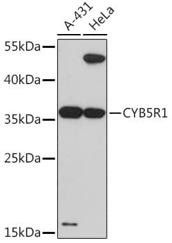 Western Blot: CYB5R1 Antibody [NBP3-35726] - Western blot analysis of various lysates using CYB5R1 Rabbit pAb at 1:3000 dilution.Secondary antibody: HRP-conjugated Goat anti-Rabbit IgG (H+L) at 1:10000 dilution.Lysates/proteins: 25ug per lane.Blocking buffer: 3% nonfat dry milk in TBST.Detection: ECL Basic Kit.Exposure time: 90s.