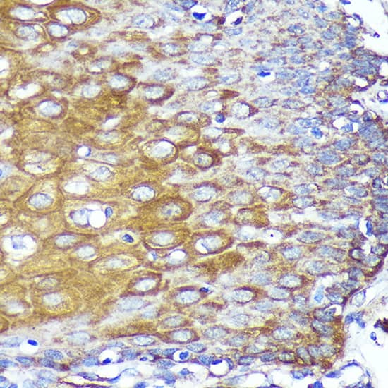 Immunohistochemistry: CYB5R1 Antibody [NBP3-35726] - Immunohistochemistry analysis of paraffin-embedded Human esophageal using CYB5R1 Rabbit pAb at dilution of 1:100 (40x lens). Microwave antigen retrieval performed with 0.01M PBS Buffer (pH 7.2) prior to IHC staining.