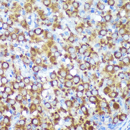 Immunohistochemistry: CYB5R1 Antibody [NBP3-35726] - Immunohistochemistry analysis of paraffin-embedded Rat ovary using CYB5R1 Rabbit pAb at dilution of 1:100 (40x lens). Microwave antigen retrieval performed with 0.01M PBS Buffer (pH 7.2) prior to IHC staining.