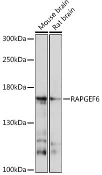 Western Blot: RAGEF2 Antibody [NBP3-35727] - Western blot analysis of various lysates using RAGEF2 Rabbit pAb at 1:1000 dilution.Secondary antibody: HRP-conjugated Goat anti-Rabbit IgG (H+L) at 1:10000 dilution.Lysates/proteins: 25ug per lane.Blocking buffer: 3% nonfat dry milk in TBST.Detection: ECL Basic Kit.Exposure time: 30s.