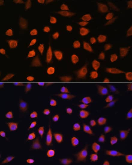 Immunocytochemistry/ Immunofluorescence: EDEM2 Antibody [NBP3-35729] - Immunofluorescence analysis of L929 cells using EDEM2 Rabbit pAb at dilution of 1:100. Secondary antibody: Cy3-conjugated Goat anti-Rabbit IgG (H+L) at 1:500 dilution. Blue: DAPI for nuclear staining.