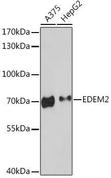 Western Blot: EDEM2 Antibody [NBP3-35729] - Western blot analysis of various lysates using EDEM2 Rabbit pAb at 1:3000 dilution.Secondary antibody: HRP-conjugated Goat anti-Rabbit IgG (H+L) at 1:10000 dilution.Lysates/proteins: 25ug per lane.Blocking buffer: 3% nonfat dry milk in TBST.Detection: ECL Enhanced Kit.Exposure time: 90s.