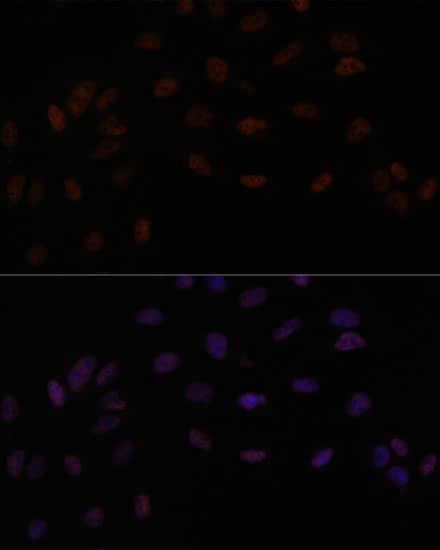 Immunocytochemistry/ Immunofluorescence SMEK2 Antibody