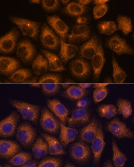Immunocytochemistry/ Immunofluorescence CaMKV Antibody - BSA Free