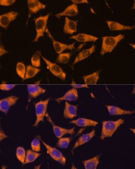 Immunocytochemistry/ Immunofluorescence: CaMKV Antibody [NBP3-35732] - Immunofluorescence analysis of L929 cells using CaMKV Rabbit pAb at dilution of 1:100. Secondary antibody: Cy3-conjugated Goat anti-Rabbit IgG (H+L) at 1:500 dilution. Blue: DAPI for nuclear staining.