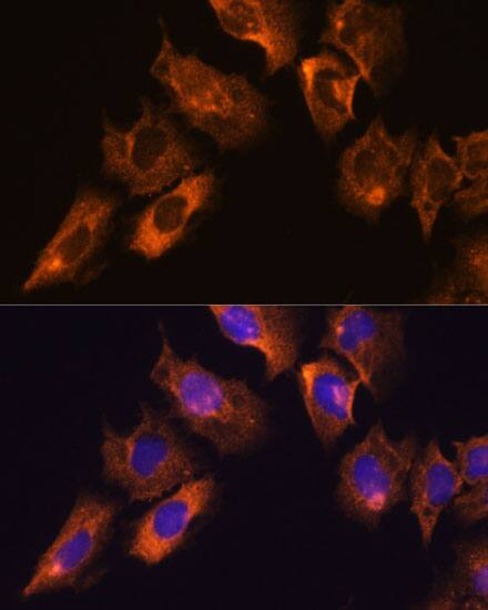 Immunocytochemistry/ Immunofluorescence: CaMKV Antibody [NBP3-35732] - Immunofluorescence analysis of C6 cells using CaMKV Rabbit pAb at dilution of 1:100. Secondary antibody: Cy3-conjugated Goat anti-Rabbit IgG (H+L) at 1:500 dilution. Blue: DAPI for nuclear staining.