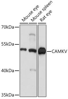Western Blot: CaMKV Antibody [NBP3-35732] - Western blot analysis of various lysates using CaMKV Rabbit pAb at 1:1000 dilution.Secondary antibody: HRP-conjugated Goat anti-Rabbit IgG (H+L) at 1:10000 dilution.Lysates/proteins: 25ug per lane.Blocking buffer: 3% nonfat dry milk in TBST.Detection: ECL Basic Kit.Exposure time: 1s.