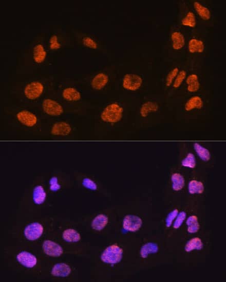 Immunocytochemistry/ Immunofluorescence: MAML2 Antibody [NBP3-35734] - Immunofluorescence analysis of C6 cells using MAML2 Rabbit pAb at dilution of 1:100. Secondary antibody: Cy3-conjugated Goat anti-Rabbit IgG (H+L) at 1:500 dilution. Blue: DAPI for nuclear staining.