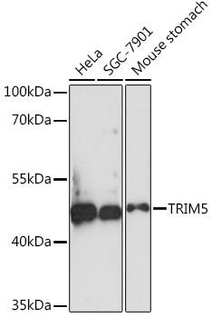 Western Blot: TRIM5 alpha Antibody [NBP3-35735] - Western blot analysis of various lysates using TRIM5 alpha Rabbit pAb at 1:1000 dilution.Secondary antibody: HRP-conjugated Goat anti-Rabbit IgG (H+L) at 1:10000 dilution.Lysates/proteins: 25ug per lane.Blocking buffer: 3% nonfat dry milk in TBST.Detection: ECL Basic Kit.Exposure time: 90s.