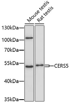 Western Blot: Lass5 Antibody [NBP3-35736] - Western blot analysis of various lysates using Lass5 Rabbit pAb at 1:1000 dilution.Secondary antibody: HRP-conjugated Goat anti-Rabbit IgG (H+L) at 1:10000 dilution.Lysates/proteins: 25ug per lane.Blocking buffer: 3% nonfat dry milk in TBST.Detection: ECL Basic Kit.Exposure time: 90s.