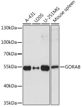 Western Blot: SCYL1BP1 Antibody [NBP3-35737] - Western blot analysis of various lysates using SCYL1BP1 Rabbit pAb at 1:1000 dilution.Secondary antibody: HRP-conjugated Goat anti-Rabbit IgG (H+L) at 1:10000 dilution.Lysates/proteins: 25ug per lane.Blocking buffer: 3% nonfat dry milk in TBST.Detection: ECL Basic Kit.Exposure time: 1s.