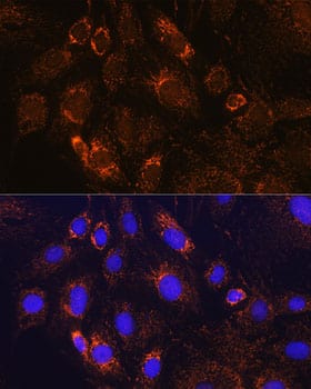 Immunocytochemistry/ Immunofluorescence: PDE12 Antibody [NBP3-35739] - Immunofluorescence analysis of C6 cells using PDE12 Rabbit pAb at dilution of 1:100. Secondary antibody: Cy3-conjugated Goat anti-Rabbit IgG (H+L) at 1:500 dilution. Blue: DAPI for nuclear staining.