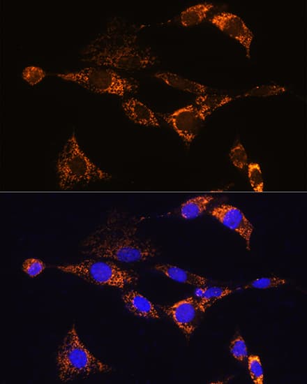 Immunocytochemistry/ Immunofluorescence: PDE12 Antibody [NBP3-35739] - Immunofluorescence analysis of NIH/3T3 cells using PDE12 Rabbit pAb at dilution of 1:100. Secondary antibody: Cy3-conjugated Goat anti-Rabbit IgG (H+L) at 1:500 dilution. Blue: DAPI for nuclear staining.
