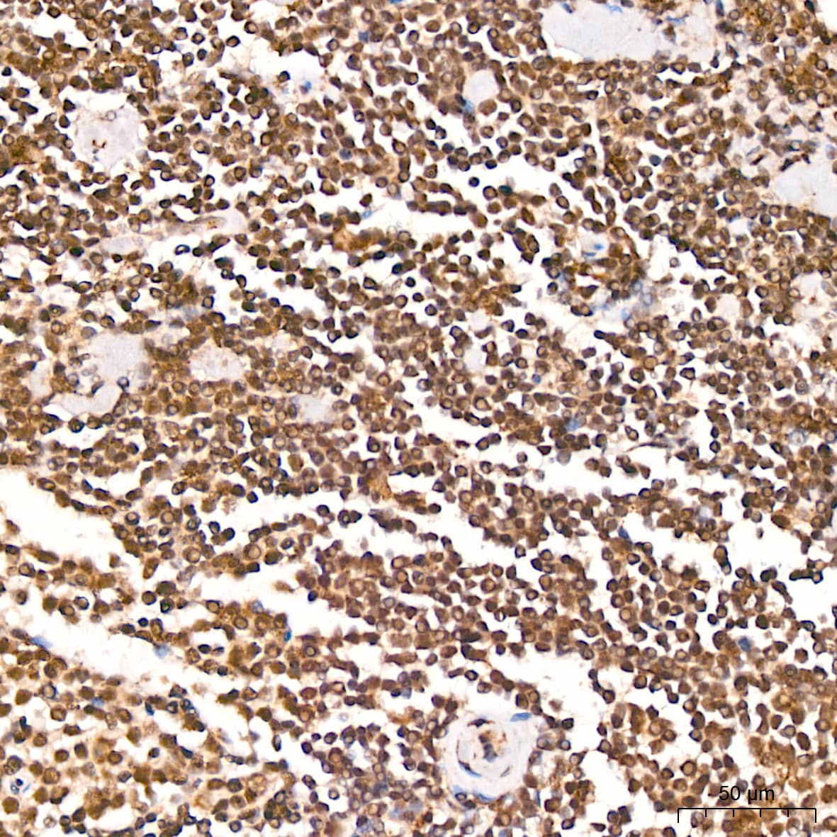 Immunohistochemistry: TET2 Antibody [NBP3-35741] - Immunohistochemistry analysis of paraffin-embedded Human spleen tissue using TET2 Rabbit pAb at a dilution of 1:200 (40x lens). High pressure antigen retrieval was performed with 0.01 M citrate buffer (pH 6.0) prior to IHC staining.