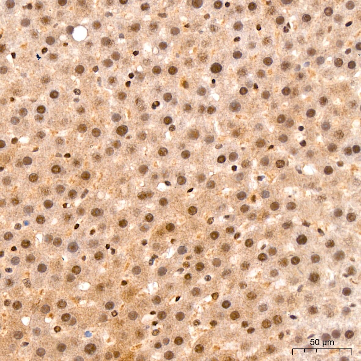 Immunohistochemistry: TET2 Antibody [NBP3-35741] - Immunohistochemistry analysis of paraffin-embedded Rat liver tissue using TET2 Rabbit pAb at a dilution of 1:200 (40x lens). High pressure antigen retrieval was performed with 0.01 M citrate buffer (pH 6.0) prior to IHC staining.