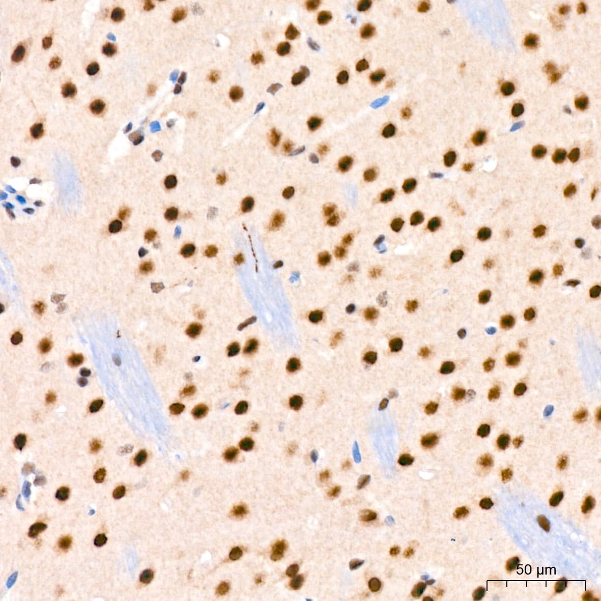 Immunohistochemistry: TET2 Antibody [NBP3-35741] - Immunohistochemistry analysis of paraffin-embedded Mouse brain tissue using TET2 Rabbit pAb at a dilution of 1:200 (40x lens). High pressure antigen retrieval was performed with 0.01 M citrate buffer (pH 6.0) prior to IHC staining.