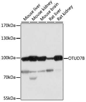 Western Blot: OTUD7B/Cezanne/ZA20D1 Antibody [NBP3-35742] - Western blot analysis of various lysates using OTUD7B/Cezanne/ZA20D1 Rabbit pAb at 1:1000 dilution.Secondary antibody: HRP-conjugated Goat anti-Rabbit IgG (H+L) at 1:10000 dilution.Lysates/proteins: 25ug per lane.Blocking buffer: 3% nonfat dry milk in TBST.Detection: ECL Basic Kit.Exposure time: 10s.