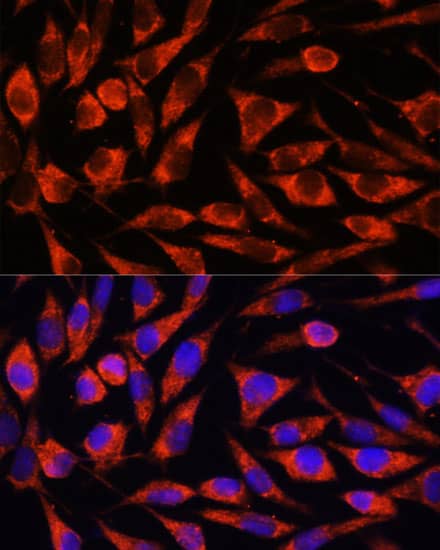 Immunocytochemistry/ Immunofluorescence: OTUD7B/Cezanne/ZA20D1 Antibody [NBP3-35742] - Immunofluorescence analysis of L929 cells using OTUD7B/Cezanne/ZA20D1 Rabbit pAb at dilution of 1:100. Secondary antibody: Cy3-conjugated Goat anti-Rabbit IgG (H+L) at 1:500 dilution. Blue: DAPI for nuclear staining.