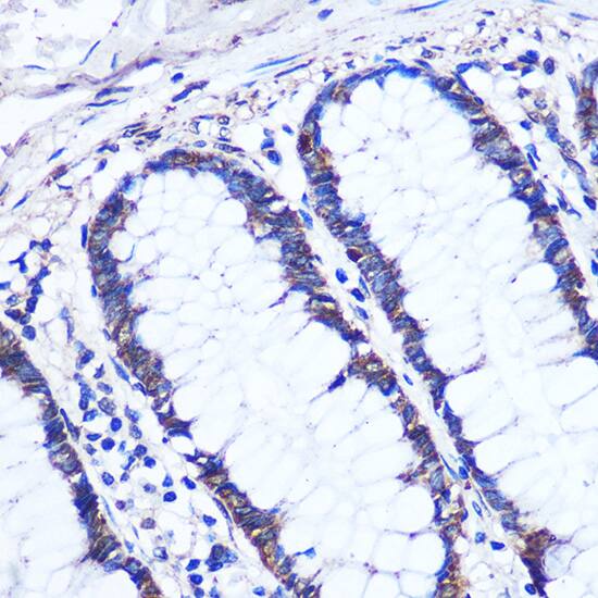 Immunohistochemistry: OTUD7B/Cezanne/ZA20D1 Antibody [NBP3-35742] - Immunohistochemistry analysis of paraffin-embedded Human colon using OTUD7B/Cezanne/ZA20D1 Rabbit pAb at dilution of 1:100 (40x lens). Microwave antigen retrieval performed with 0.01M PBS Buffer (pH 7.2) prior to IHC staining.