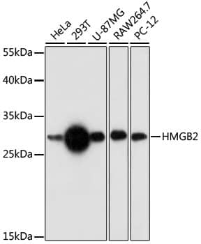 Western Blot: HMGB2 Antibody [NBP3-35743] - Western blot analysis of various lysates using HMGB2 Rabbit pAb at 1:1000 dilution.Secondary antibody: HRP-conjugated Goat anti-Rabbit IgG (H+L) at 1:10000 dilution.Lysates/proteins: 25ug per lane.Blocking buffer: 3% nonfat dry milk in TBST.Detection: ECL Basic Kit.Exposure time: 30s.