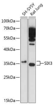 Western Blot: SIX3 Antibody [NBP3-35744] - Western blot analysis of various lysates using SIX3 Rabbit pAb at 1:1000 dilution.Secondary antibody: HRP-conjugated Goat anti-Rabbit IgG (H+L) at 1:10000 dilution.Lysates/proteins: 25ug per lane.Blocking buffer: 3% nonfat dry milk in TBST.Detection: ECL Enhanced Kit.Exposure time: 3min.